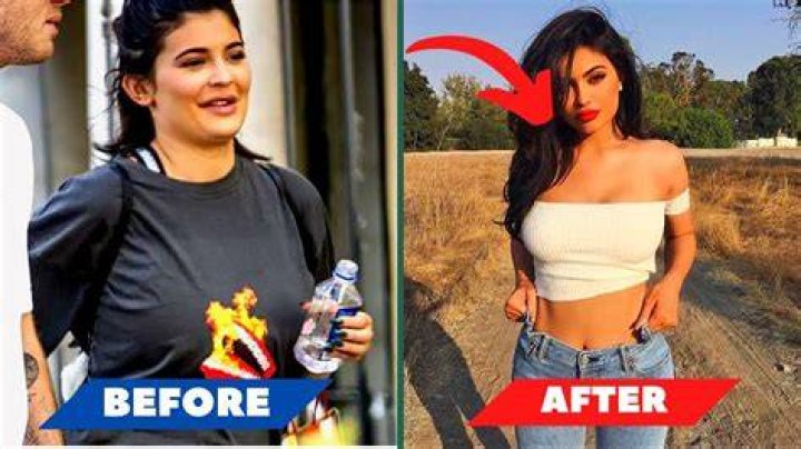Kylie Jenner Weight Loss