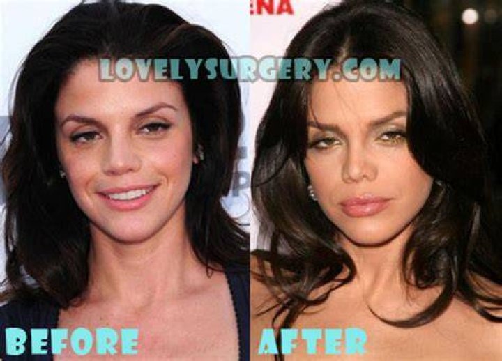 Vanessa Ferlito Nose Job Plastic Surgery Before and After
